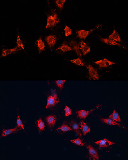 Immunocytochemistry/ Immunofluorescence ADAM11 Antibody - Azide and BSA Free