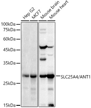 Western Blot: Adenine Nucleotide Translocase 1 Antibody - Azide and BSA Free [NBP2-92626] - Western blot analysis of various lysates, using Adenine Nucleotide Translocase 1 Rabbit pAb  at 1:1000 dilution.Secondary antibody: HRP Goat Anti-Rabbit IgG (H+L)  at 1:10000 dilution.Lysates/proteins: 25ug per lane.Blocking buffer: 3% nonfat dry milk in TBST.Detection: ECL Basic Kit.Exposure time: 10s.