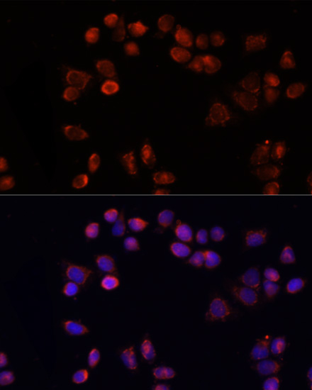 Immunocytochemistry/ Immunofluorescence: Adenine Nucleotide Translocase 1 Antibody - Azide and BSA Free [NBP2-92626] - Immunofluorescence analysis of HeLa cells using Adenine Nucleotide Translocase 1 antibody  at dilution of 1:100 (40x lens). Blue: DAPI for nuclear staining.