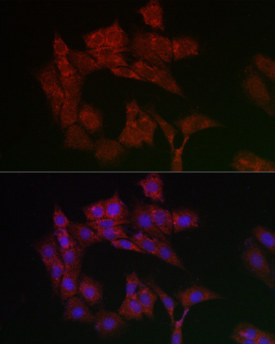 Immunocytochemistry/ Immunofluorescence: Adenine Nucleotide Translocase 1 Antibody - Azide and BSA Free [NBP2-92626] - Immunofluorescence analysis of PC-12 cells using Adenine Nucleotide Translocase 1 Rabbit pAb  at dilution of 1:200 (40x lens). Blue: DAPI for nuclear staining.