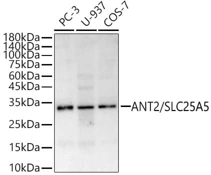 Western Blot: Adenine Nucleotide Translocator 2 Antibody - Azide and BSA Free [NBP2-92630] - Western blot analysis of various lysates, using Adenine Nucleotide Translocator 2 Rabbit pAb  at  1:1000 dilution.Secondary antibody: HRP-conjugated Goat anti-Rabbit IgG (H+L)  at 1:10000 dilution.Lysates/proteins: 25ug per lane.Blocking buffer: 3% nonfat dry milk in TBST.Detection: ECL Basic Kit.Exposure time: 60s.