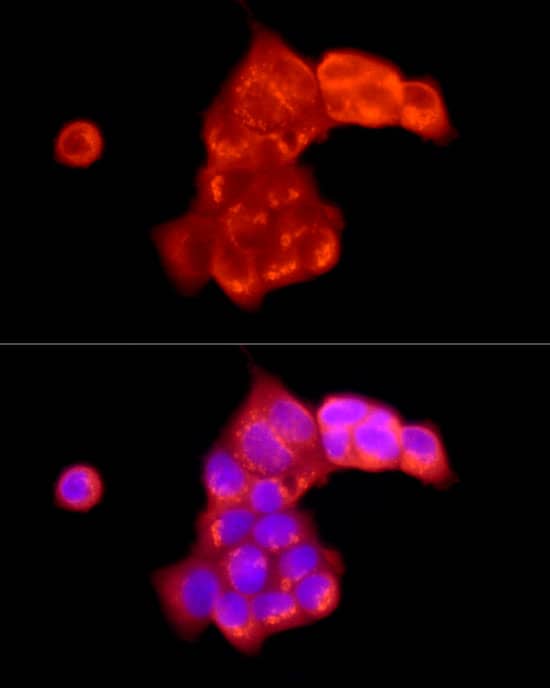 Immunocytochemistry/ Immunofluorescence: ATP6V0C Antibody - Azide and BSA Free [NBP2-92634] - Immunofluorescence analysis of MCF7 cells using ATP6V0C Rabbit pAb  at dilution of 1:100 (40x lens). Secondary antibody: Cy3-conjugated Goat anti-Rabbit IgG (H+L)  at 1:500 dilution. Blue: DAPI for nuclear staining.