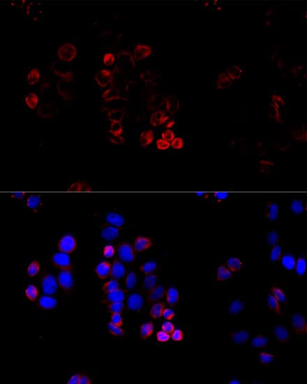 Immunocytochemistry/ Immunofluorescence: ABCG8 Antibody - BSA Free [NBP2-92641] - Immunofluorescence analysis of HeLa cells using ABCG8 Rabbit pAb  at dilution of 1:100 (40x lens). Secondary antibody: Cy3-conjugated Goat anti-Rabbit IgG (H+L)  at 1:500 dilution. Blue: DAPI for nuclear staining.