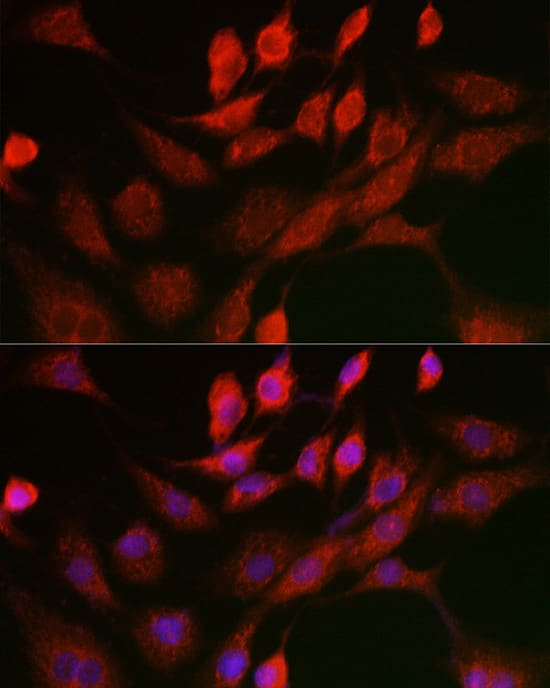 Immunocytochemistry/ Immunofluorescence: Adenine Nucleotide Translocase 1 Antibody - Azide and BSA Free [NBP2-92642] - Immunofluorescence analysis of NIH/3T3 cells using Adenine Nucleotide Translocase 1 Rabbit pAb  at dilution of 1:100 (40x lens). Secondary antibody: Cy3-conjugated Goat anti-Rabbit IgG (H+L)  at 1:500 dilution. Blue: DAPI for nuclear staining.