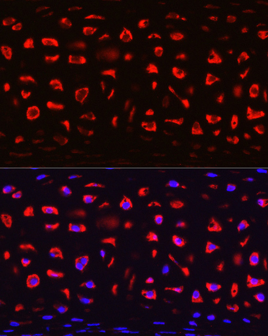 Immunocytochemistry/ Immunofluorescence: COMP/Thrombospondin-5 Antibody - Azide and BSA Free [NBP2-92658] - Immunofluorescence analysis of Rat cartilage using COMP/Thrombospondin-5 Rabbit pAb  at dilution of 1:200 (40x lens). Blue: DAPI for nuclear staining.