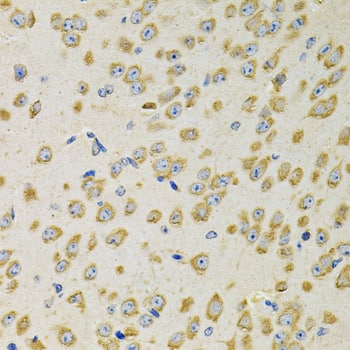 Immunohistochemistry: Adenylosuccinate Synthase Antibody - BSA Free [NBP2-92661] - Immunohistochemistry analysis of paraffin-embedded Mouse brain using Adenylosuccinate Synthase Rabbit pAb  at dilution of 1:100 (40x lens). Microwave antigen retrieval performed with 0.01M PBS Buffer (pH 7.2) prior to IHC staining.