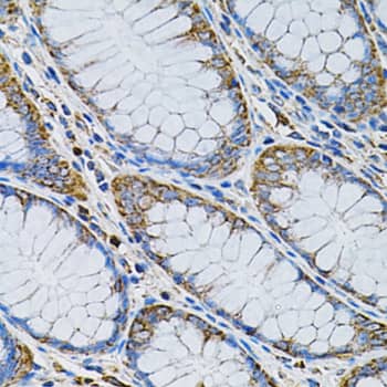 Immunohistochemistry: Adenylosuccinate Synthase Antibody - BSA Free [NBP2-92661] - Immunohistochemistry analysis of paraffin-embedded Human colon using Adenylosuccinate Synthase Rabbit pAb  at dilution of 1:100 (40x lens). Microwave antigen retrieval performed with 0.01M PBS Buffer (pH 7.2) prior to IHC staining.