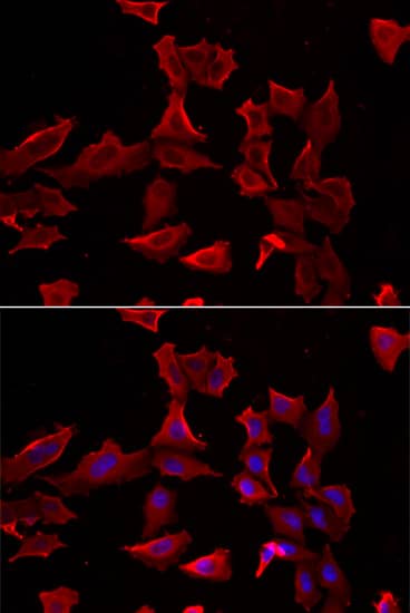 Immunocytochemistry/ Immunofluorescence: Adenylosuccinate Synthase Antibody - BSA Free [NBP2-92661] - Immunofluorescence analysis of HeLa cells using Adenylosuccinate Synthase Rabbit pAb . Secondary antibody: Cy3-conjugated Goat anti-Rabbit IgG (H+L)  at 1:500 dilution. Blue: DAPI for nuclear staining.