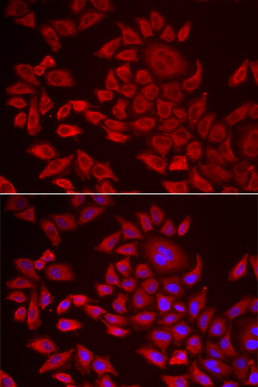 Immunocytochemistry/ Immunofluorescence: AGPAT2 Antibody - BSA Free [NBP2-92662] - Immunofluorescence analysis of HeLa cells using AGPAT2 antibody . Blue: DAPI for nuclear staining.