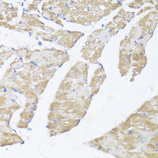 Immunohistochemistry ASMT Antibody - BSA Free