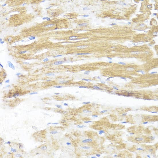 Immunohistochemistry ASMT Antibody - BSA Free