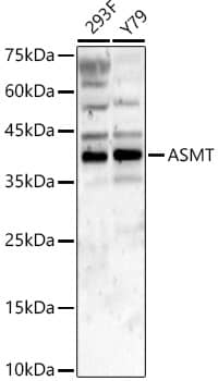 Western Blot: ASMT Antibody - BSA Free [NBP2-92663] - Western blot analysis of various lysates, using ASMT Rabbit pAb at 1:2000 dilution.Secondary antibody: HRP-conjugated Goat anti-Rabbit IgG (H+L) at 1:10000 dilution.Lysates/proteins: 25ug per lane.Blocking buffer: 3% nonfat dry milk in TBST.Detection: ECL Basic Kit.Exposure time: 90s.