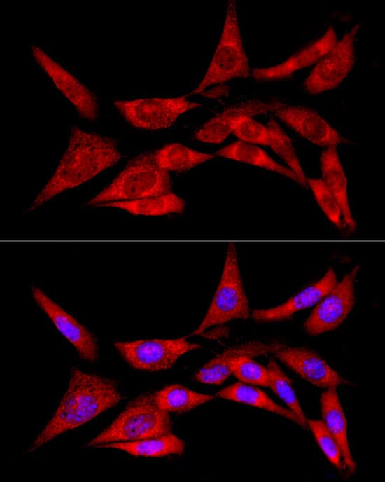 Immunocytochemistry/ Immunofluorescence: CREB3 Antibody - Azide and BSA Free [NBP2-92664] - Immunofluorescence analysis of NIH/3T3 cells using CREB3 Rabbit pAb  at dilution of 1:100 (40x lens). Secondary antibody: Cy3-conjugated Goat anti-Rabbit IgG (H+L)  at 1:500 dilution. Blue: DAPI for nuclear staining.