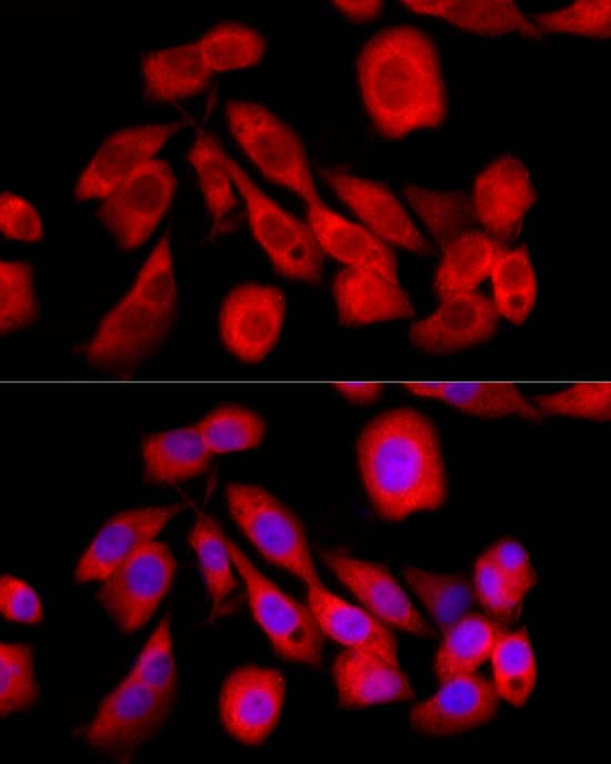 Immunocytochemistry/ Immunofluorescence: CREB3 Antibody - Azide and BSA Free [NBP2-92664] - Immunofluorescence analysis of PC-3 cells using CREB3 Rabbit pAb  at dilution of 1:100 (40x lens). Secondary antibody: Cy3-conjugated Goat anti-Rabbit IgG (H+L)  at 1:500 dilution. Blue: DAPI for nuclear staining.