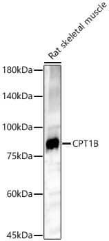 Western Blot: CPT1B Antibody - BSA Free [NBP2-92666] - Western blot analysis of lysates from Rat skeletal muscle, using CPT1B Rabbit pAb  at 1:500 dilution.Secondary antibody: HRP-conjugated Goat anti-Rabbit IgG (H+L)  at 1:10000 dilution.Lysates/proteins: 25ug per lane.Blocking buffer: 3% nonfat dry milk in TBST.Detection: ECL Basic Kit.Exposure time: 180s.