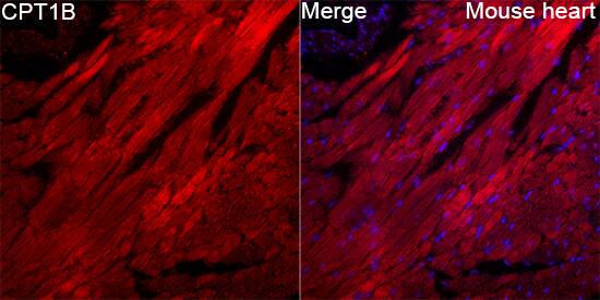 Immunocytochemistry/ Immunofluorescence: CPT1B Antibody - BSA Free [NBP2-92666] - Immunofluorescence analysis of Mouse heart tissue using CPT1B Rabbit pAb  at a dilution of 1:100 (40x lens). Secondary antibody: Cy3-conjugated Goat anti-Rabbit IgG (H+L) at 1:500 dilution. Blue: DAPI for nuclear staining. High pressure antigen retrieval performed with 0.01M Citrate Buffer(pH 6.0) prior to IF staining.