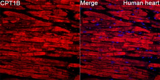 Immunocytochemistry/ Immunofluorescence: CPT1B Antibody - BSA Free [NBP2-92666] - Immunofluorescence analysis of Human heart tissue using CPT1B Rabbit pAb  at a dilution of 1:100 (40x lens). Secondary antibody: Cy3-conjugated Goat anti-Rabbit IgG (H+L) at 1:500 dilution. Blue: DAPI for nuclear staining. High pressure antigen retrieval performed with 0.01M Citrate Buffer(pH 6.0) prior to IF staining.