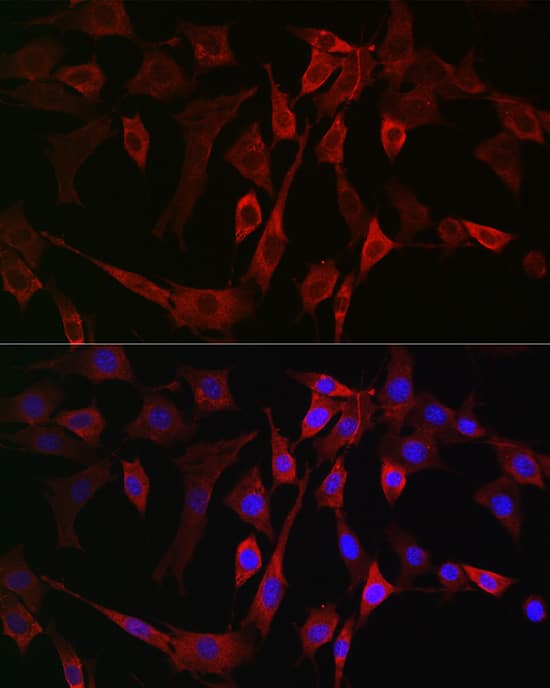 Immunocytochemistry/ Immunofluorescence 15-Lipoxygenase 2 Antibody - Azide and BSA Free