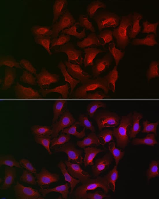 Immunocytochemistry/ Immunofluorescence 15-Lipoxygenase 2 Antibody - Azide and BSA Free