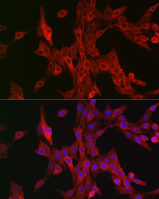 Immunocytochemistry/ Immunofluorescence: 15-Lipoxygenase 2 Antibody - Azide and BSA Free [NBP2-92668] - Immunofluorescence analysis of PC-12 cells using 15-Lipoxygenase 2 Rabbit pAb  at dilution of 1:100 (40x lens). Secondary antibody: Cy3-conjugated Goat anti-Rabbit IgG (H+L)  at 1:500 dilution. Blue: DAPI for nuclear staining.