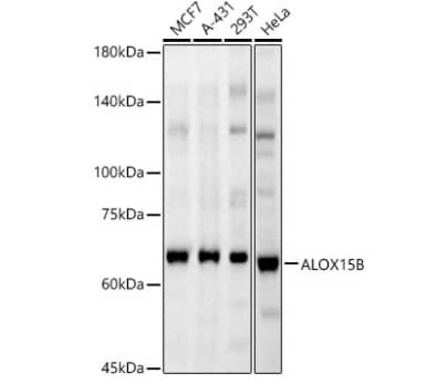 Western Blot 15-Lipoxygenase 2 Antibody - Azide and BSA Free