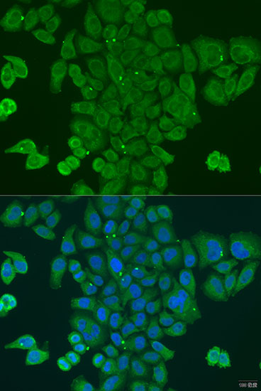Immunocytochemistry/ Immunofluorescence: DPM1 Antibody - BSA Free [NBP2-92678] - Immunofluorescence analysis of U2OS cells using DPM1 antibody  at dilution of 1:100. Blue: DAPI for nuclear staining.