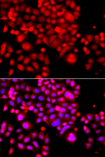 Immunocytochemistry/ Immunofluorescence: ASCC3 Antibody - BSA Free [NBP2-92682] - Immunofluorescence analysis of A549 cells using ASCC3 antibody . Blue: DAPI for nuclear staining.