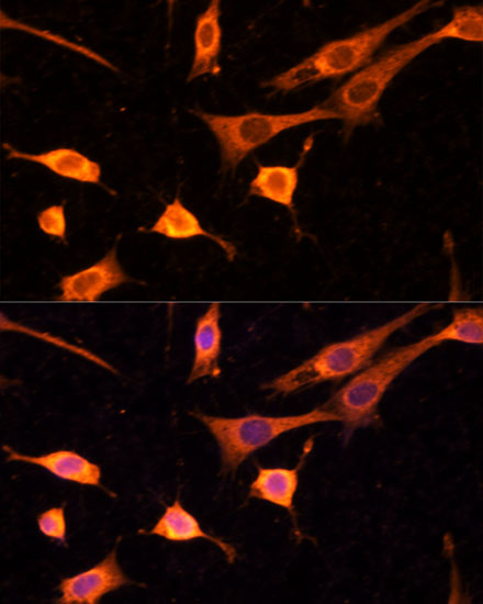 Immunocytochemistry/ Immunofluorescence: BFAR Antibody - BSA Free [NBP2-92687] - Immunofluorescence analysis of NIH-3T3 cells using BFAR Polyclonal Antibody  at dilution of 1:100 (40x lens). Blue: DAPI for nuclear staining.