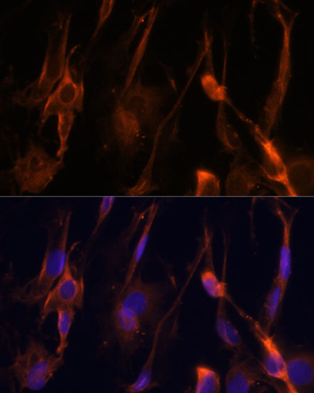 Immunocytochemistry/ Immunofluorescence: BFAR Antibody - BSA Free [NBP2-92687] - Immunofluorescence analysis of C6 cells using BFAR Polyclonal Antibody  at dilution of 1:100 (40x lens). Blue: DAPI for nuclear staining.