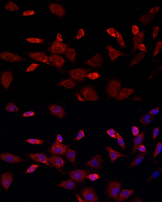 Immunocytochemistry/ Immunofluorescence: CISD1 Antibody - BSA Free [NBP2-92696] - Immunofluorescence analysis of NIH/3T3 cells using CISD1 Rabbit pAb  at dilution of 1:100 (40x lens). Blue: DAPI for nuclear staining.