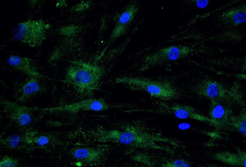 Immunocytochemistry/Immunofluorescence: COMP/Thrombospondin-5 Antibody [NBP2-92733] - Analysis of Human Dermal Fibroblasts (HDFa). Green: 1:100 COMP/Thrombospondin-5 antibody in PBS/BSA 1%, 1h room temperature Blue: DAPI. Image from verified customer review.