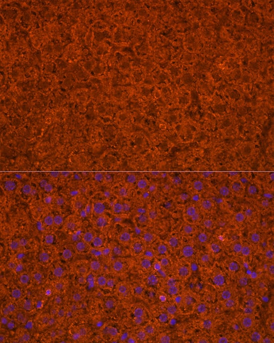 Immunocytochemistry/ Immunofluorescence: Apolipoprotein CIII Antibody - Azide and BSA Free [NBP2-92734] - Immunofluorescence analysis of paraffin-embedded mouse liver using Apolipoprotein CIII Rabbit pAb  at dilution of 1:200 (40x lens). Secondary antibody: Cy3 Goat Anti-Rabbit IgG (H+L)  at 1:500 dilution. Blue: DAPI for nuclear staining.