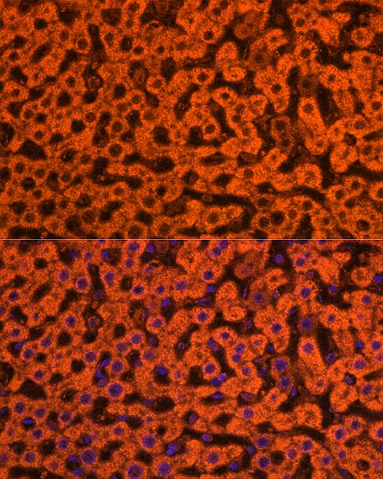 Immunocytochemistry/ Immunofluorescence: Apolipoprotein CIII Antibody - Azide and BSA Free [NBP2-92734] - Immunofluorescence analysis of paraffin-embedded rat liver using Apolipoprotein CIII Rabbit pAb  at dilution of 1:200 (40x lens). Secondary antibody: Cy3 Goat Anti-Rabbit IgG (H+L)  at 1:500 dilution. Blue: DAPI for nuclear staining.