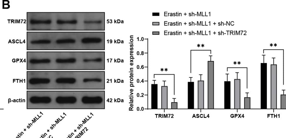 Inhibition of TRIM72 partially reverses the inhibitory effect of MLL1 inhibition on ferroptosis of HTR-8/SVneo cells. HTR-8/SVneo cells were transfected with sh-TRIM72, with sh-NC as the control. A: Detection of transfection efficiency by qRT-PCR; then HTR-8/SVneo cells were treated with sh-MLL1 for a combined experiment. B: Detection of TRIM72, ASCL4, GPX4, and FTH1 expressions in cells by Western blot. C: Detection of cell viability by CCK-8 assay. D-F: Detection of MDA, Fe2+, and GSH levels in cells by kits. G: Detection of ROS levels in cells by fluorescence. H: Detection of cell invasion and migration by Transwell. The cell experiments were repeated three times independently. Data in panel A were analyzed by t test. Data in panels CDEFGH were analyzed by one-way ANOVA, and data in panel B were analyzed by two-way ANOVA, followed by Tukey’s multiple comparisons test. *P < 0.05, **P < 0.01 Image collected and cropped by CiteAb from the following open publication (//biologydirect.biomedcentral.com/articles/10.1186/s13062-024-00572-0), licensed under a CC-BY license. Not internally tested by Novus Biologicals.