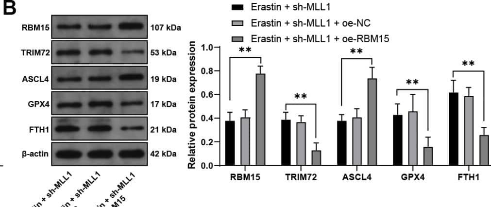 Overexpression of RBM15 partially reverses the inhibitory effect of MLL1 inhibition on ferroptosis of HTR-8/SVneo cells. HTR-8/SVneo cells were transfected with oe-RBM15, with oe-NC as the control. A: Detection of transfection efficiency by qRT-PCR; then HTR-8/SVneo cells were treated with sh-MLL1 for a combined experiment. B: Detection of RBM15, TRIM72, ASCL4, GPX4, and FTH1 in cells by Western blot. C: Detection of cell viability by CCK-8 assay. D-F: Detection of MDA, Fe2+, and GSH levels in cells by kits. G: Detection of ROS levels in cells by fluorescence. H: Detection of cell invasion and migration by Transwell. The cell experiments were repeated three times independently. Data in panel A were analyzed by t test. Data in panels CDEFGH were analyzed by one-way ANOVA, and data in panel B were analyzed by two-way ANOVA, followed by Tukey’s multiple comparisons test. *P < 0.05, **P < 0.01 Image collected and cropped by CiteAb from the following open publication (//biologydirect.biomedcentral.com/articles/10.1186/s13062-024-00572-0), licensed under a CC-BY license. Not internally tested by Novus Biologicals.