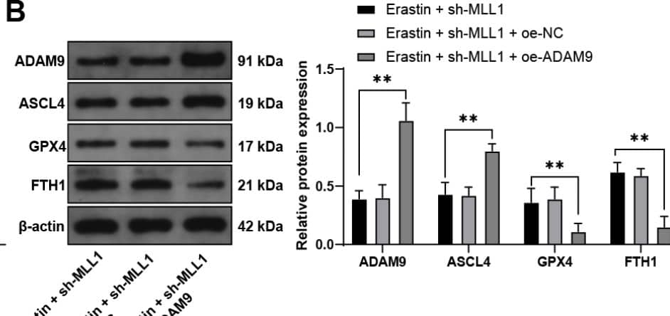 Overexpression of ADAM9 partially reverses the inhibitory effect of MLL1 inhibition on ferroptosis of HTR-8/SVneo cells. HTR-8/SVneo cells were transfected with oe-ADAM9, with oe-NC as the control. A: Detection of transfection efficiency by qRT-PCR; then HTR-8/SVneo cells were treated with sh-MLL1 for a combined experiment. B: Detection of ADAM9, ASCL4, GPX4, and FTH1 expressions in cells by Western blot. C: Detection of cell viability by CCK-8 assay. D-F: Detection of MDA, Fe2+, and GSH levels in cells by kits. G: Detection of ROS levels in cells by fluorescence. H: Detection of cell invasion and migration by Transwell. The cell experiments were repeated three times independently. Data in panel A were analyzed by t test. Data in panels CDEFGH were analyzed by one-way ANOVA, and data in panel B were analyzed by two-way ANOVA, followed by Tukey’s multiple comparisons test. *P < 0.05, **P < 0.01 Image collected and cropped by CiteAb from the following open publication (//biologydirect.biomedcentral.com/articles/10.1186/s13062-024-00572-0), licensed under a CC-BY license. Not internally tested by Novus Biologicals.