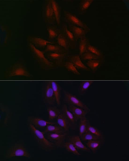 Immunocytochemistry/ Immunofluorescence: C9orf72 Antibody - Azide and BSA Free [NBP2-92755] - Immunofluorescence analysis of U2OS cells using C9orf72 Rabbit pAb  at dilution of 1:100 (40x lens). Secondary antibody: Cy3 Goat Anti-Rabbit IgG (H+L)  at 1:500 dilution. Blue: DAPI for nuclear staining.