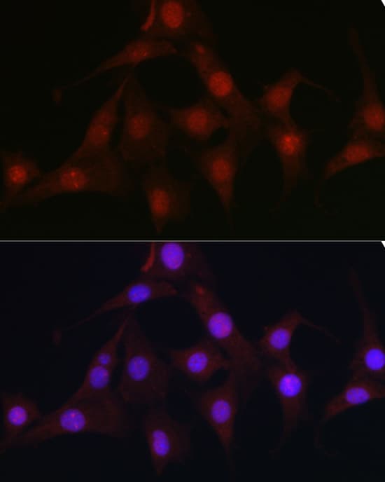 Immunocytochemistry/ Immunofluorescence: C9orf72 Antibody - Azide and BSA Free [NBP2-92755] - Immunofluorescence analysis of NIH/3T3 cells using C9orf72 Rabbit pAb  at dilution of 1:100 (40x lens). Secondary antibody: Cy3 Goat Anti-Rabbit IgG (H+L)  at 1:500 dilution. Blue: DAPI for nuclear staining.