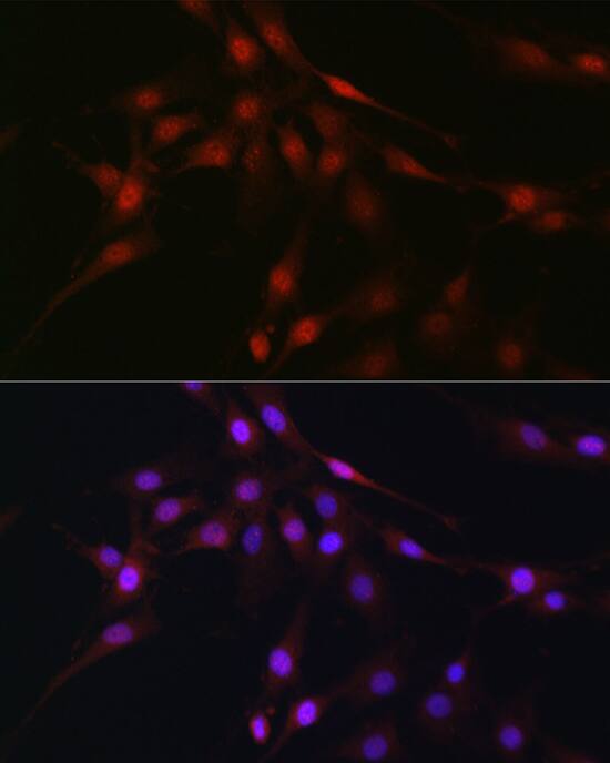 Immunocytochemistry/ Immunofluorescence: C9orf72 Antibody - Azide and BSA Free [NBP2-92755] - Immunofluorescence analysis of C6 cells using C9orf72 Rabbit pAb  at dilution of 1:100 (40x lens). Secondary antibody: Cy3 Goat Anti-Rabbit IgG (H+L)  at 1:500 dilution. Blue: DAPI for nuclear staining.