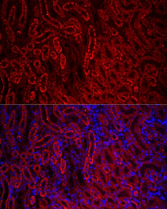 Immunocytochemistry/ Immunofluorescence: ACSL1 Antibody - Azide and BSA Free [NBP2-92757] - Immunofluorescence analysis of paraffin-embedded mouse kidney using ACSL1 Rabbit pAb  at dilution of 1:200 (40x lens). Secondary antibody: Cy3-conjugated Goat anti-Rabbit IgG (H+L)  at 1:500 dilution. Blue: DAPI for nuclear staining.