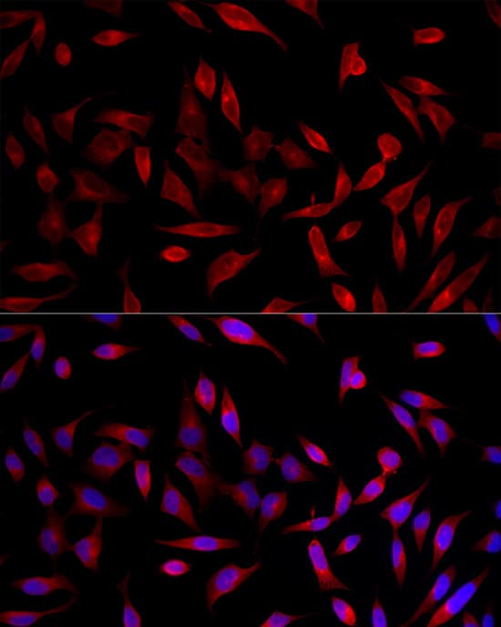 Immunocytochemistry/ Immunofluorescence: ACSL1 Antibody - Azide and BSA Free [NBP2-92757] - Immunofluorescence analysis of HeLa cells using ACSL1 Rabbit pAb  at dilution of 1:200 (40x lens). Secondary antibody: Cy3-conjugated Goat anti-Rabbit IgG (H+L)  at 1:500 dilution. Blue: DAPI for nuclear staining.