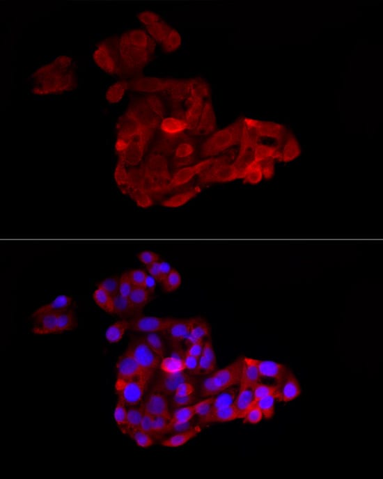 Immunocytochemistry/ Immunofluorescence: ACSL1 Antibody - Azide and BSA Free [NBP2-92757] - Immunofluorescence analysis of HepG2 cells using ACSL1 Rabbit pAb  at dilution of 1:200 (40x lens). Secondary antibody: Cy3-conjugated Goat anti-Rabbit IgG (H+L)  at 1:500 dilution. Blue: DAPI for nuclear staining.