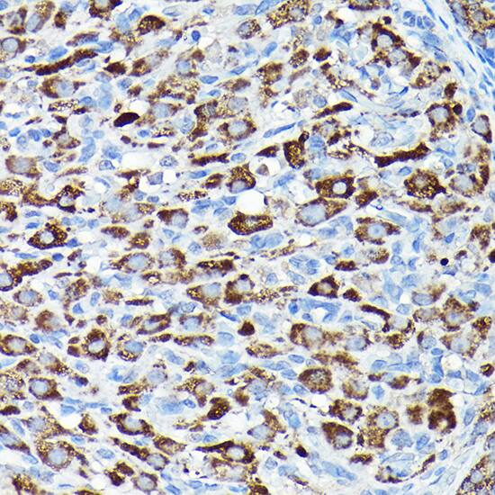 Immunohistochemistry: CYP11A1 Antibody - Azide and BSA Free [NBP2-92759] - Immunohistochemistry analysis of paraffin-embedded Rat ovary using CYP11A1 Rabbit pAb  at dilution of 1:200 (40x lens). High pressure antigen retrieval performed with 0.01M Citrate Bufferr (pH 6.0) prior to IHC staining.