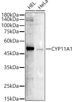 Western Blot: CYP11A1 Antibody - Azide and BSA Free [NBP2-92759] - Western blot analysis of various lysates using CYP11A1 Rabbit pAb  at 1:800 dilution.Secondary antibody: HRP-conjugated Goat anti-Rabbit IgG (H+L)  at 1:10000 dilution.Lysates/proteins: 25ug per lane.Blocking buffer: 3% nonfat dry milk in TBST.Detection: ECL Basic Kit.Exposure time: 90s.