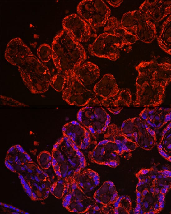 Immunocytochemistry/ Immunofluorescence: CYP11A1 Antibody - Azide and BSA Free [NBP2-92759] - Immunofluorescence analysis of paraffin-embedded human placenta using CYP11A1 Rabbit pAb  at dilution of 1:100 (40x lens). Secondary antibody: Cy3-conjugated Goat anti-Rabbit IgG (H+L)  at 1:500 dilution. Blue: DAPI for nuclear staining.