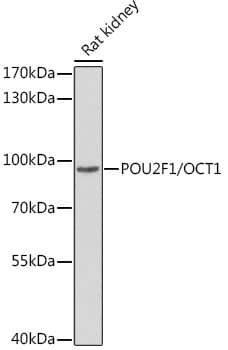 Western Blot: OCT1 Antibody - BSA Free [NBP2-92761] - Western blot analysis of lysates from rat kidney, using 45931 Rabbit pAb  at 1:1000 dilution.Secondary antibody: HRP Goat Anti-Rabbit IgG (H+L)  at 1:10000 dilution.Lysates/proteins: 25ug per lane.Blocking buffer: 3% nonfat dry milk in TBST.Detection: ECL Basic Kit.Exposure time: 15s.