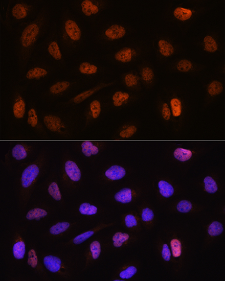 Immunocytochemistry/ Immunofluorescence: CSTF2T Antibody - BSA Free [NBP2-92782] - Immunofluorescence analysis of U2OS cells using CSTF2T Rabbit pAb  at dilution of 1:100. Blue: DAPI for nuclear staining.