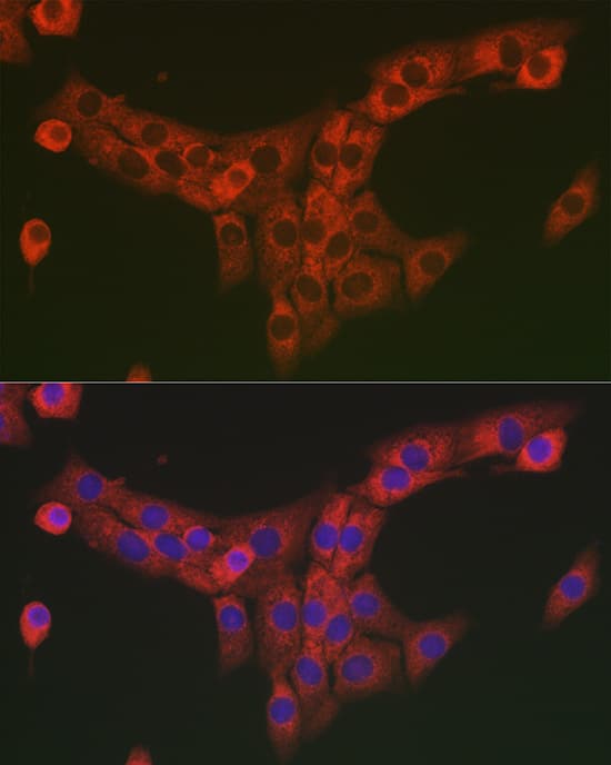 Immunocytochemistry/ Immunofluorescence: COL1A2 Antibody - Azide and BSA Free [NBP2-92790] - Immunofluorescence analysis of NIH/3T3 cells using COL1A2 Rabbit pAb  at dilution of 1:25. Secondary antibody: Cy3-conjugated Goat anti-Rabbit IgG (H+L)  at 1:500 dilution. Blue: DAPI for nuclear staining.