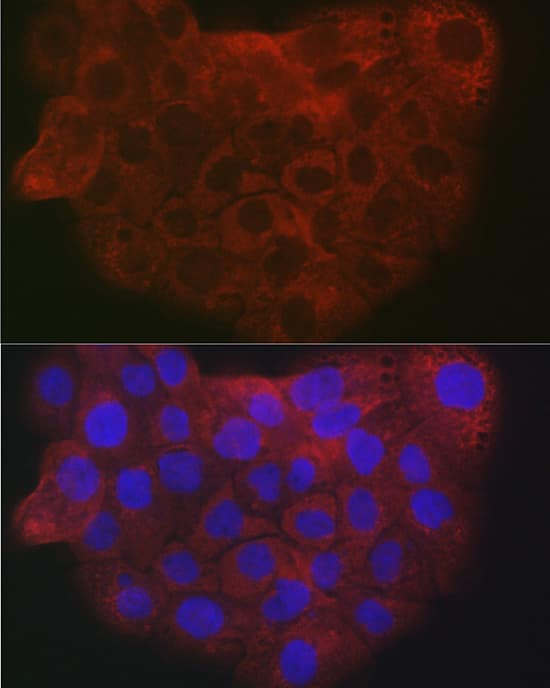 Immunocytochemistry/ Immunofluorescence COL1A2 Antibody - Azide and BSA Free