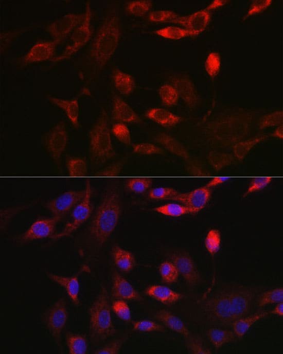 Immunocytochemistry/ Immunofluorescence: BNIP3L Antibody - Azide and BSA Free [NBP2-92792] - Immunofluorescence analysis of NIH/3T3 cells using BNIP3L Rabbit pAb  at dilution of 1:100 (40x lens). Secondary antibody: Cy3-conjugated Goat anti-Rabbit IgG (H+L)  at 1:500 dilution. Blue: DAPI for nuclear staining.